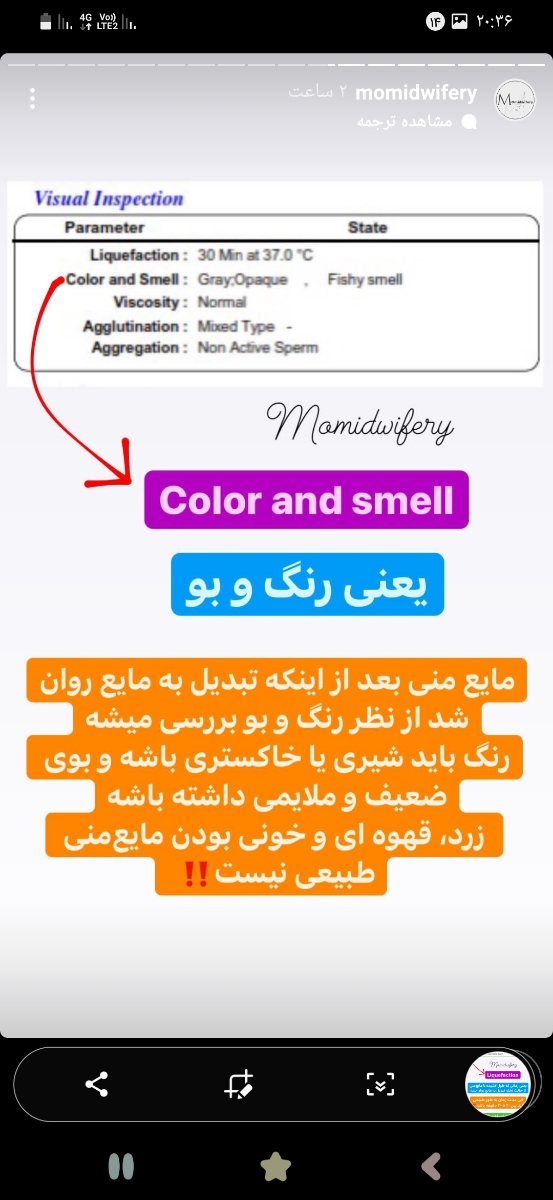 تفسیر ازمایش اسپرم همسرم تفسیر ازمایش اسپرم همسرم
