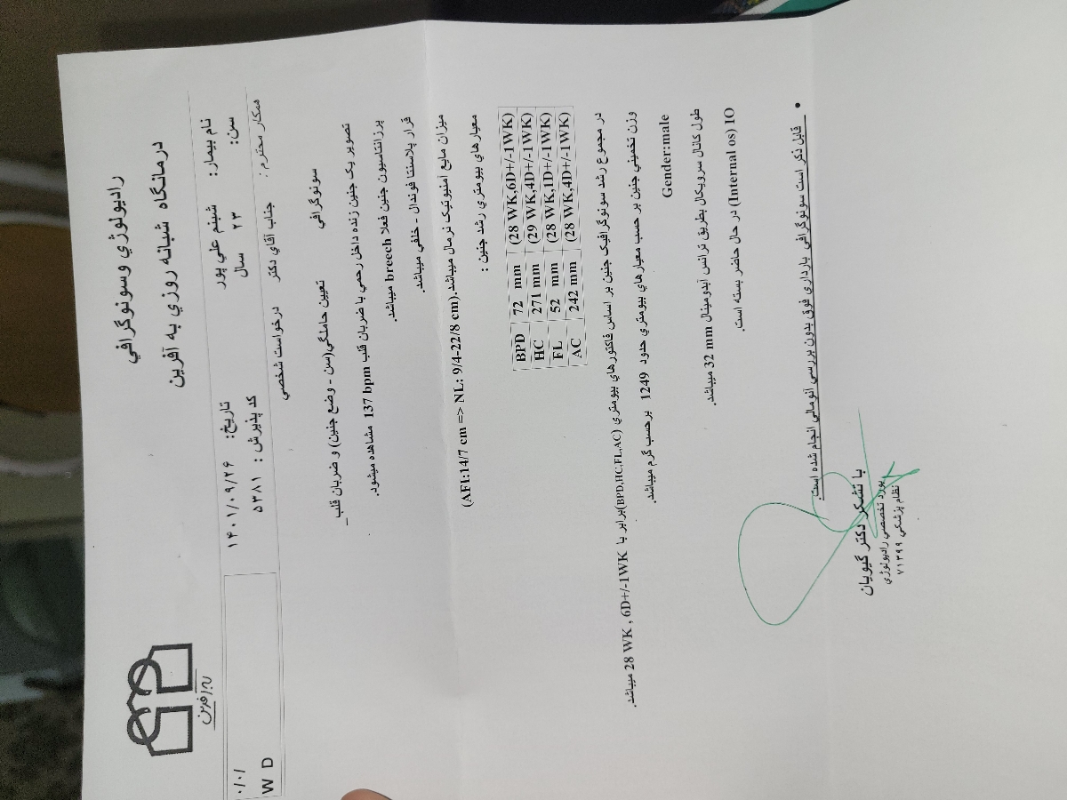 اینجا بریچ بوده اینجا بریچ بوده