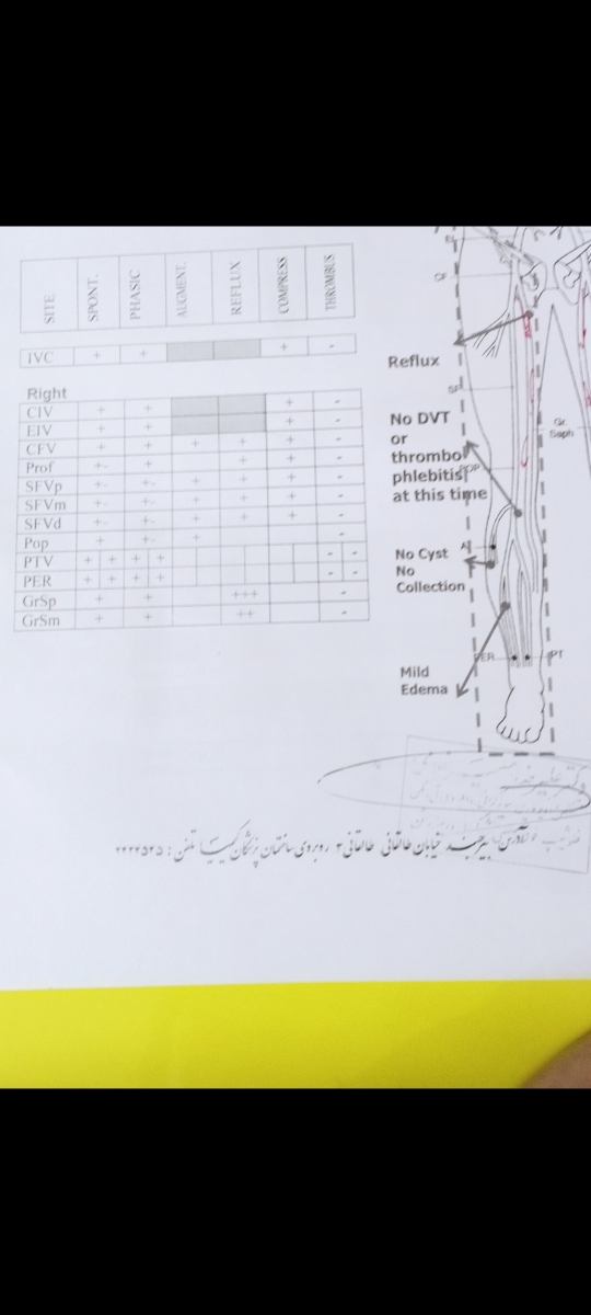 تفسیر سونوگرافی پای پدرم تفسیر سونوگرافی پای پدرم