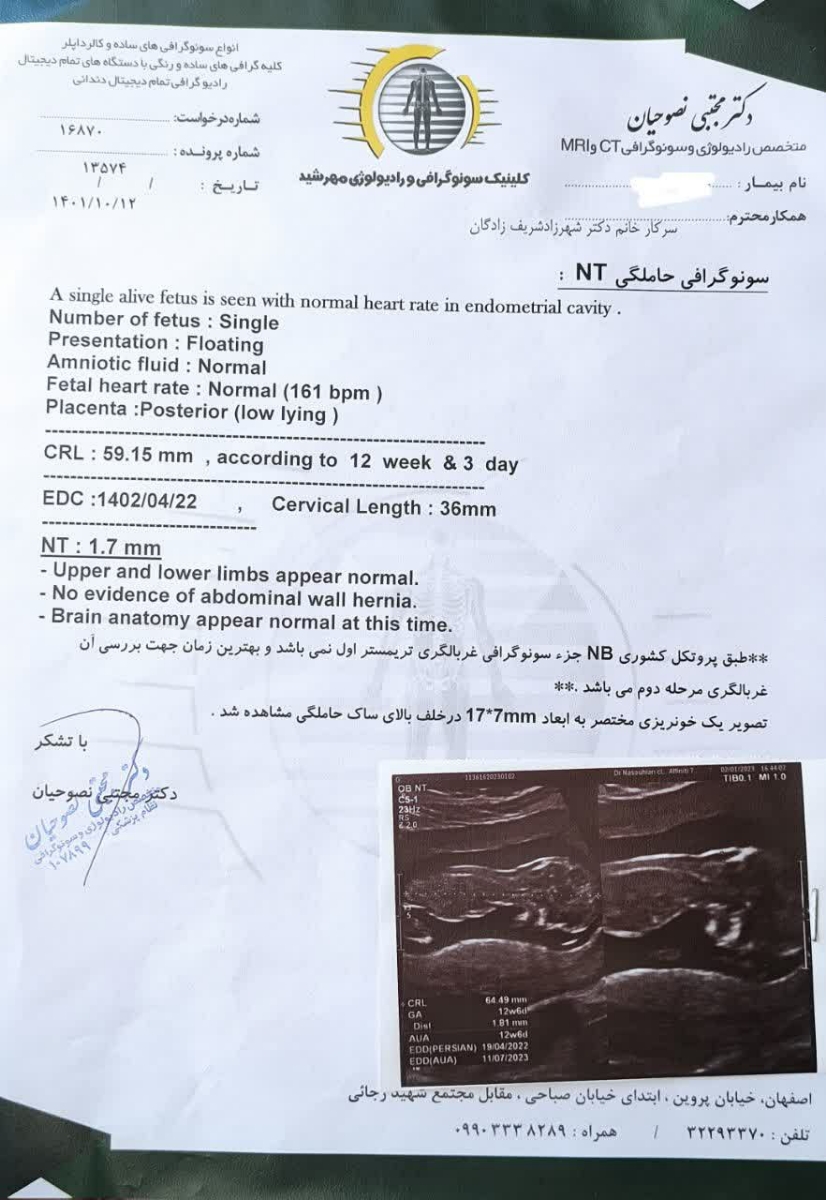 تفسیر سونو ان تی و آزمایش