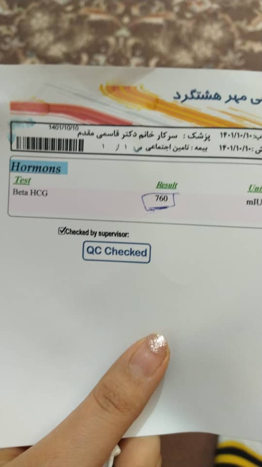 سونو و ازمایش بارداری
