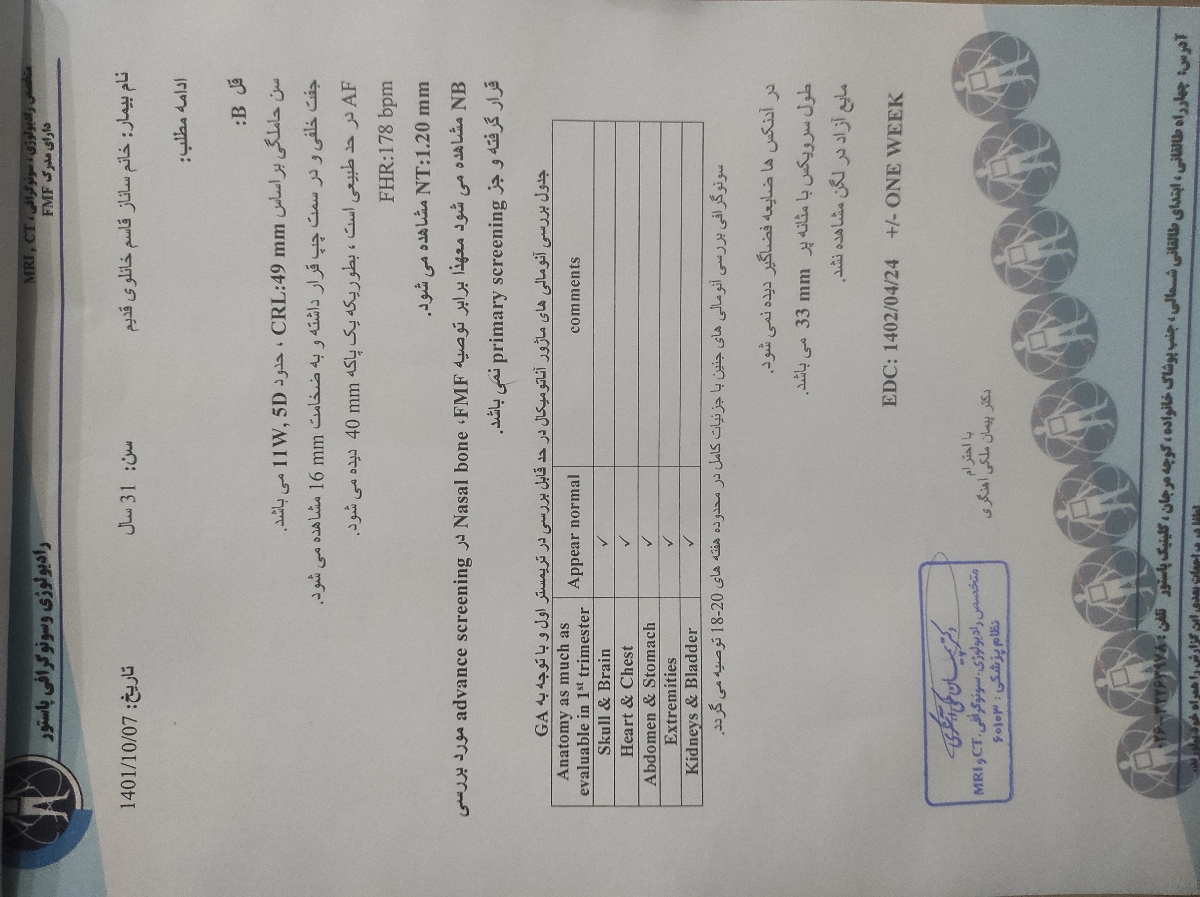 تفسیر غربالگری اول دوقلویی تفسیر غربالگری اول دوقلویی