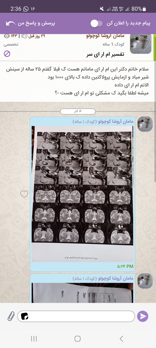 تفسیر ام ار ای سر مامانم
