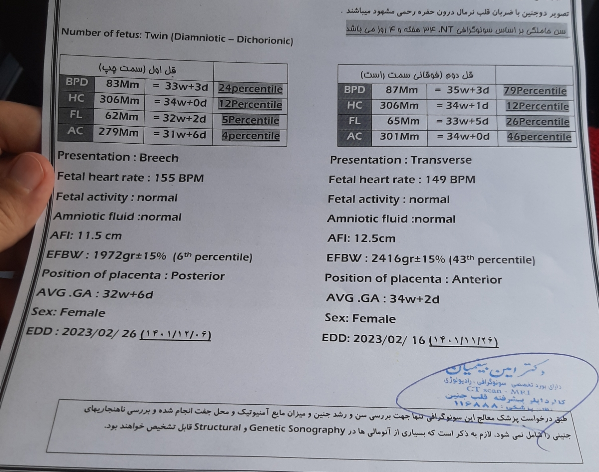 سونو داپلر و رشد نکردن یکی از قل ها در بارداری دو قلویی سونو داپلر و رشد نکردن یکی از قل ها در بارداری دو قلویی
