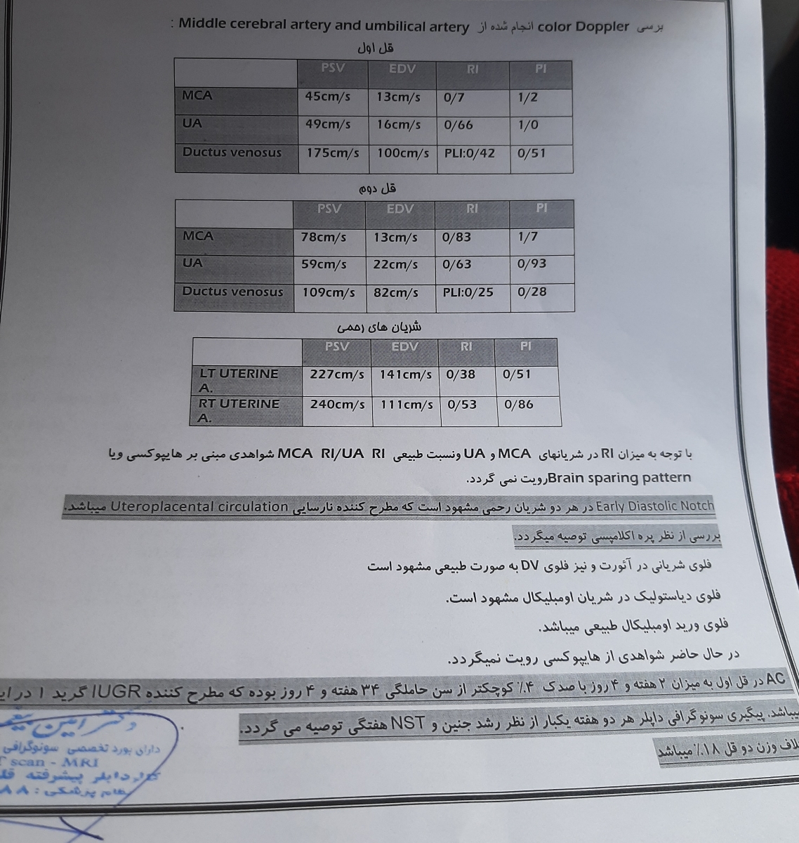 سونو داپلر و رشد نکردن یکی از قل ها در بارداری دو قلویی سونو داپلر و رشد نکردن یکی از قل ها در بارداری دو قلویی