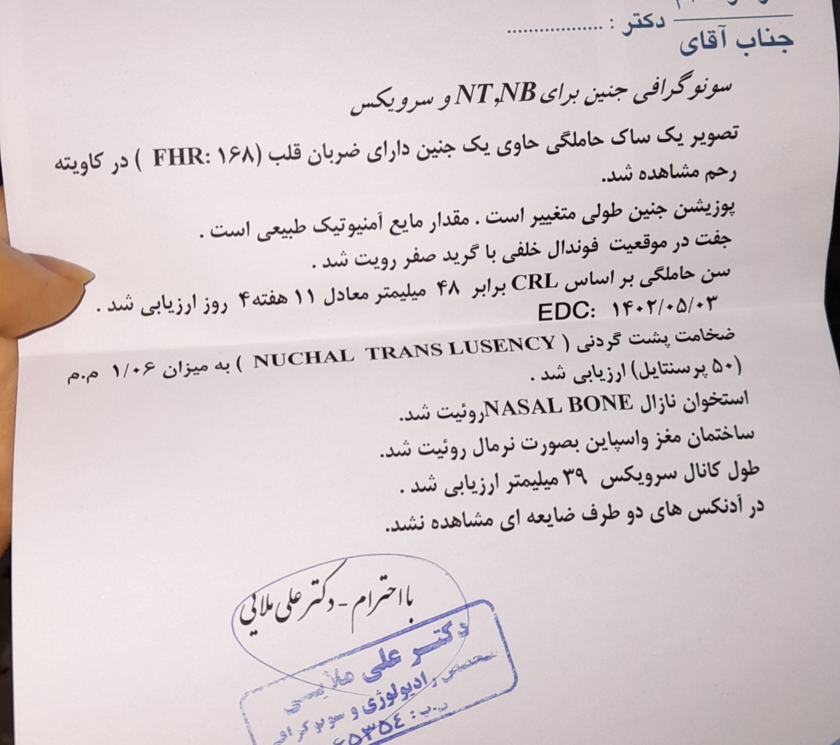 خوشگلا لطفا بیاین سونو nt و ببینین جنسیتم حدس بزنین😍