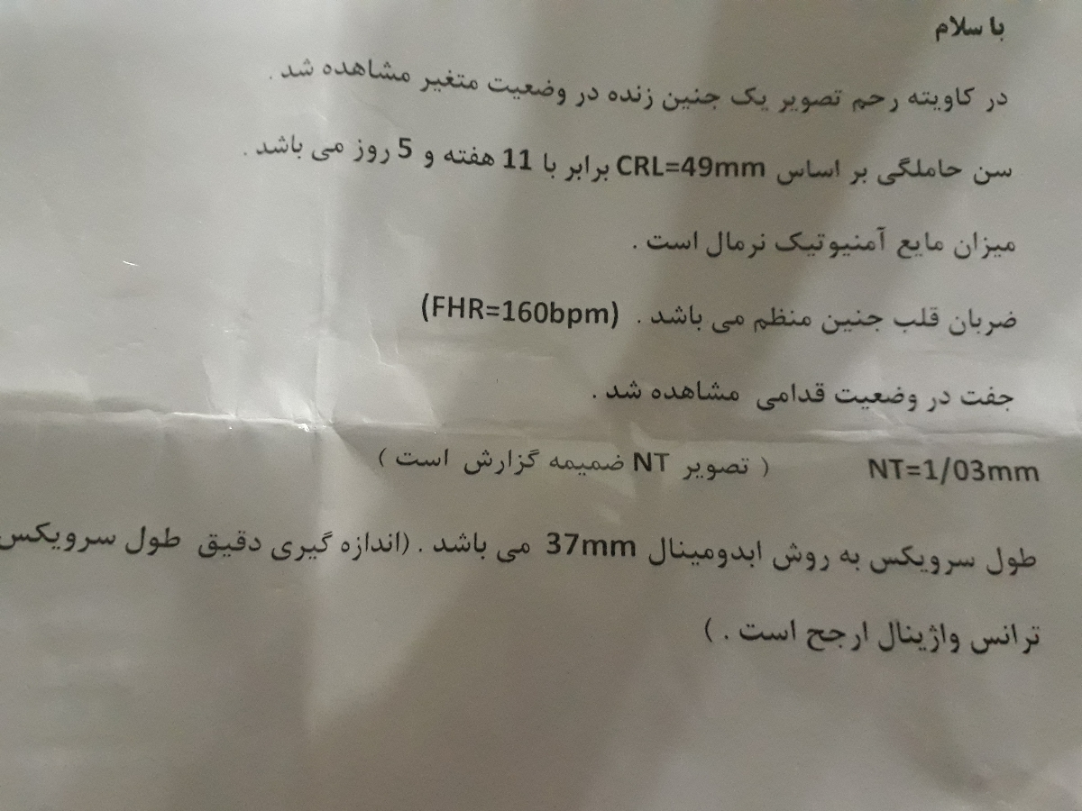 تفسیر ازمایش ان تی