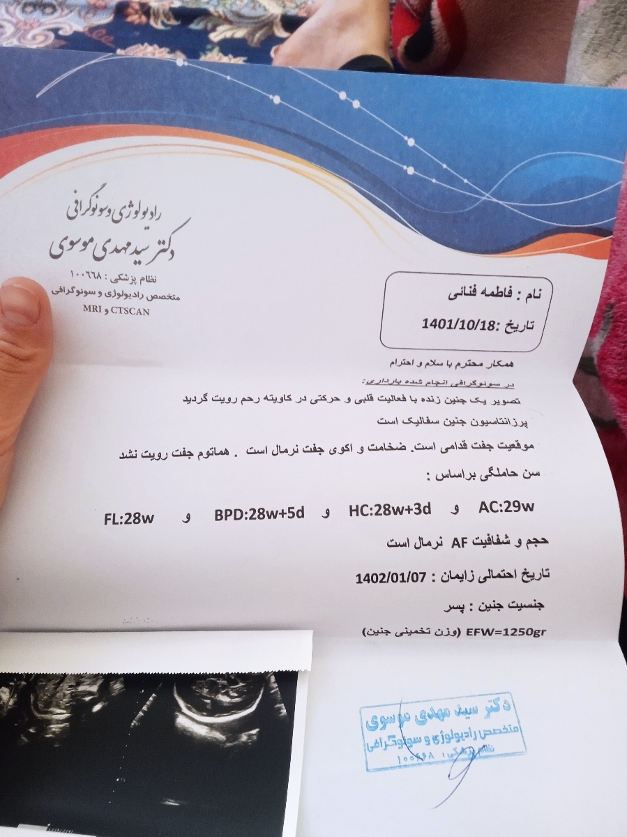 وزن جنین در 28هفته