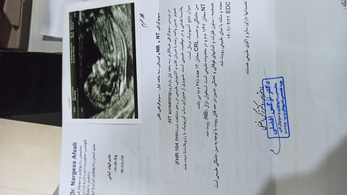 سونوگرافی nt و آزمایش غربالگری