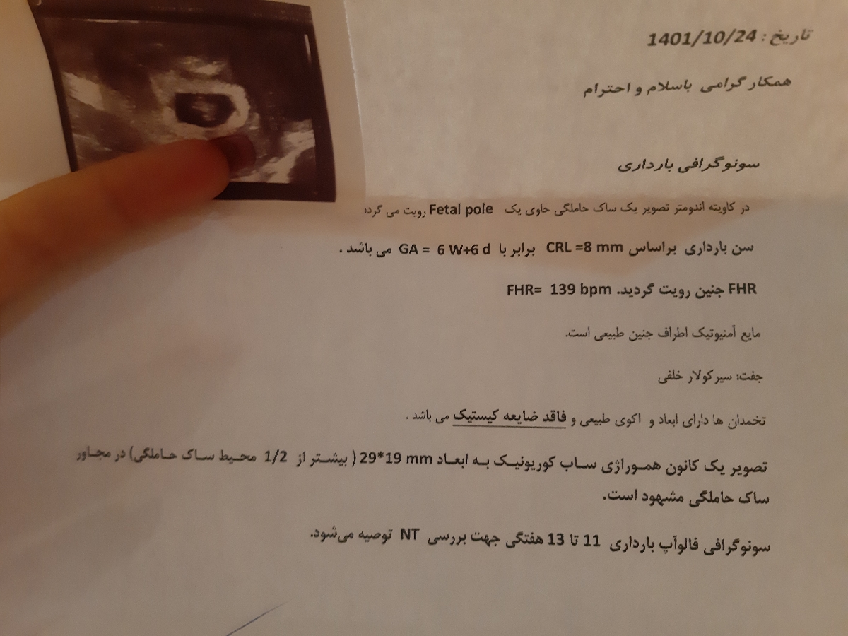 خونریزی در هفته7 بارداری خونریزی در هفته7 بارداری