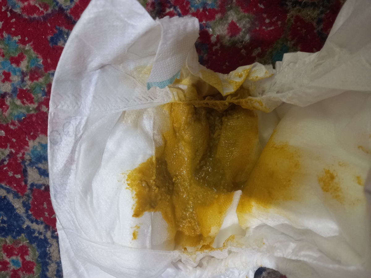 سلام نوزاد 28روزم یکم مدفوعش سبز رنگ شده