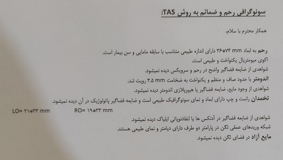 خونریزی بعد از زایمان
