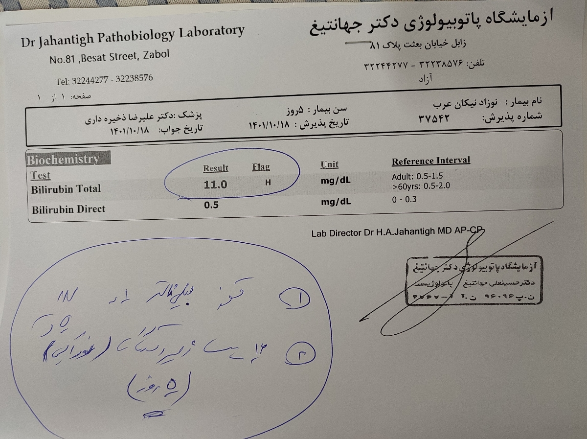 زردی و قطره بیلی ناستر