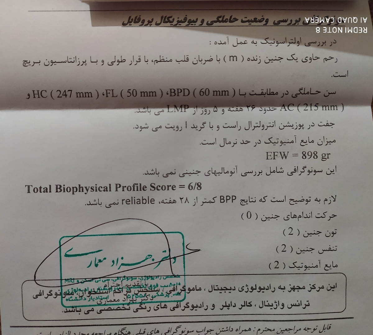 تفسیر سونوی بیوفیزیکال و حرکات کم جنین تفسیر سونوی بیوفیزیکال و حرکات کم جنین