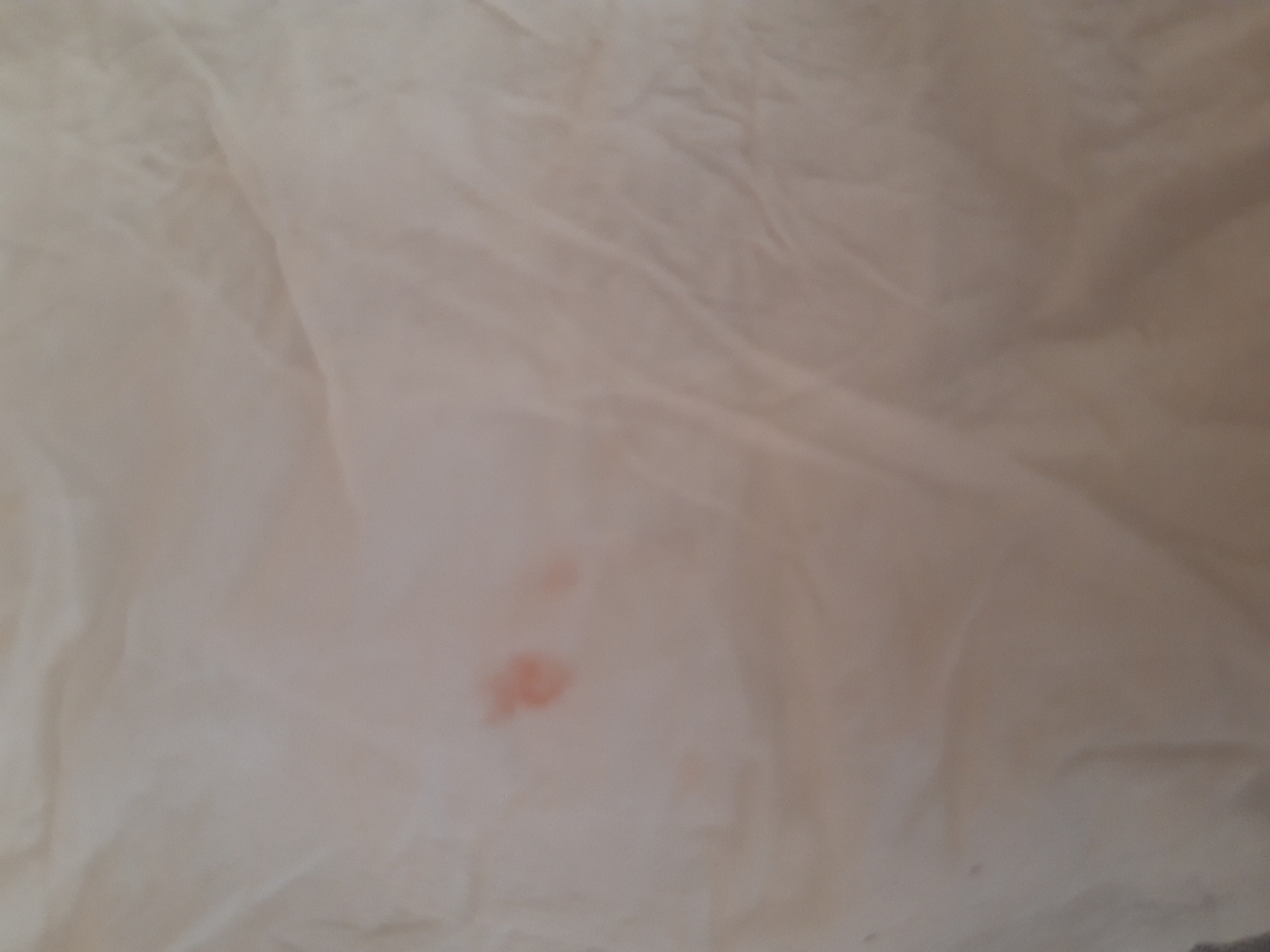 لکه بینی در هفته ۲۴