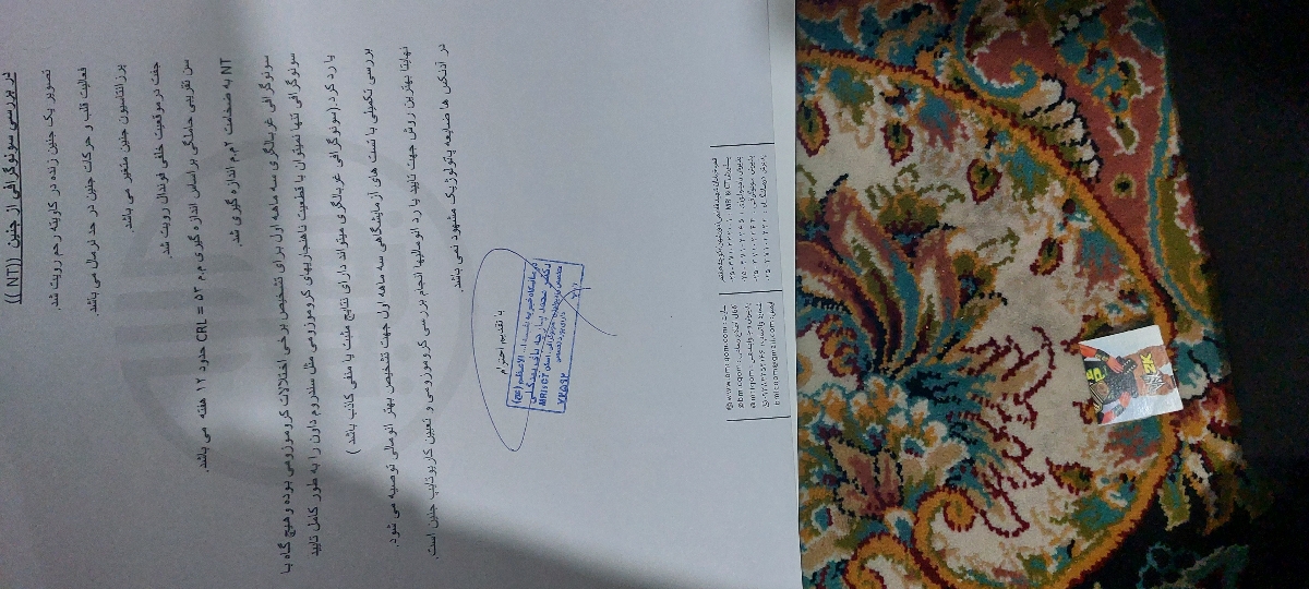سونو آن تی و آزمایش آن تی سونو آن تی و آزمایش آن تی