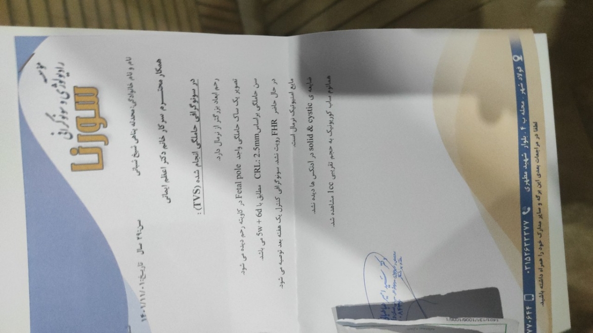 خونریزی ناشی ازهماتوم در بارداری خونریزی ناشی ازهماتوم در بارداری