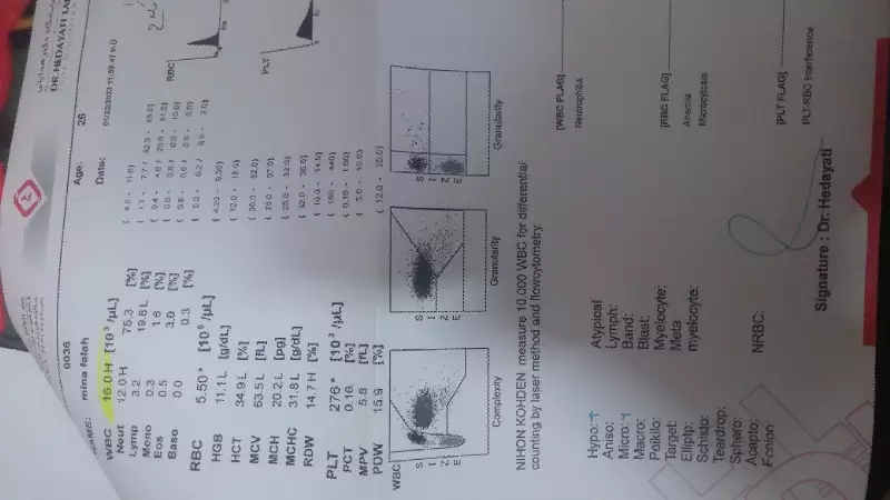 بالا بودن گلبول سفید