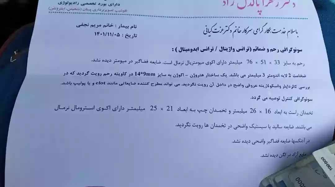 خونریزی دوماه بعداز زایمان