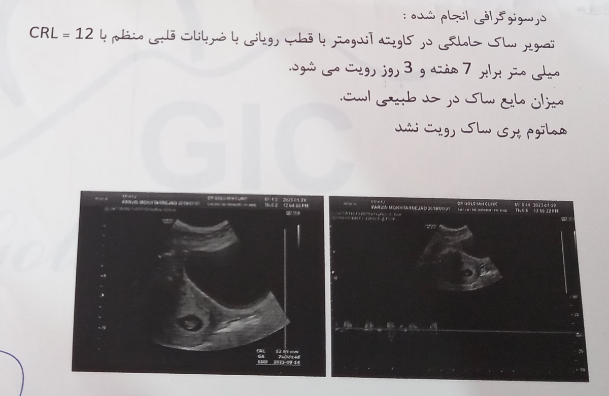 بررسی جواب سونوگرافی
