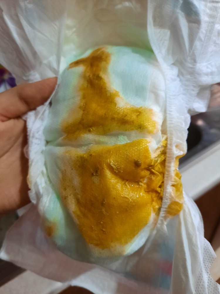 مدفوع نوزاد ۲ ماهه