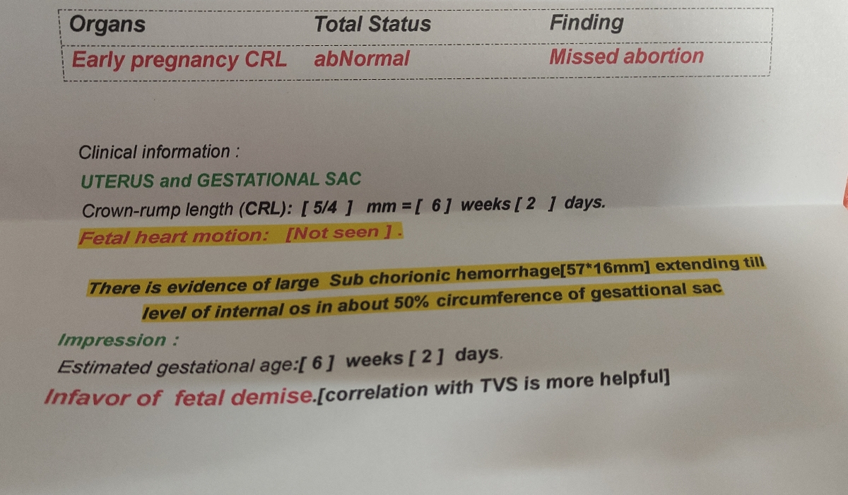 خانوما کسی بوده تاریخ اخرین روز شروع پریودش با تاریخ سونو قلب سه هفته فرق کنه خانوما کسی بوده تاریخ اخرین روز شروع پریودش با تاریخ سونو قلب سه هفته فرق کنه