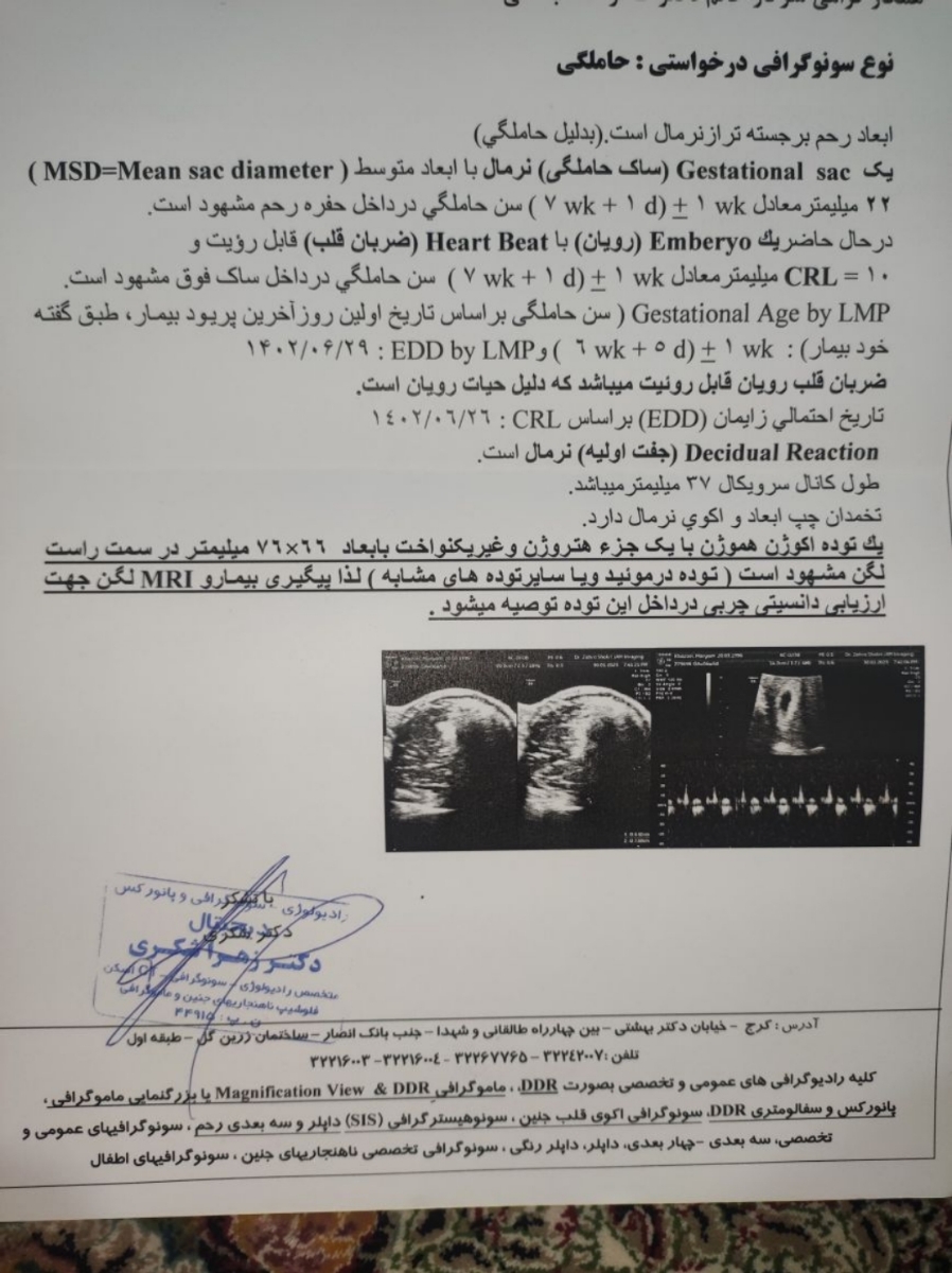 اکوژن هموژن در لگن اکوژن هموژن در لگن