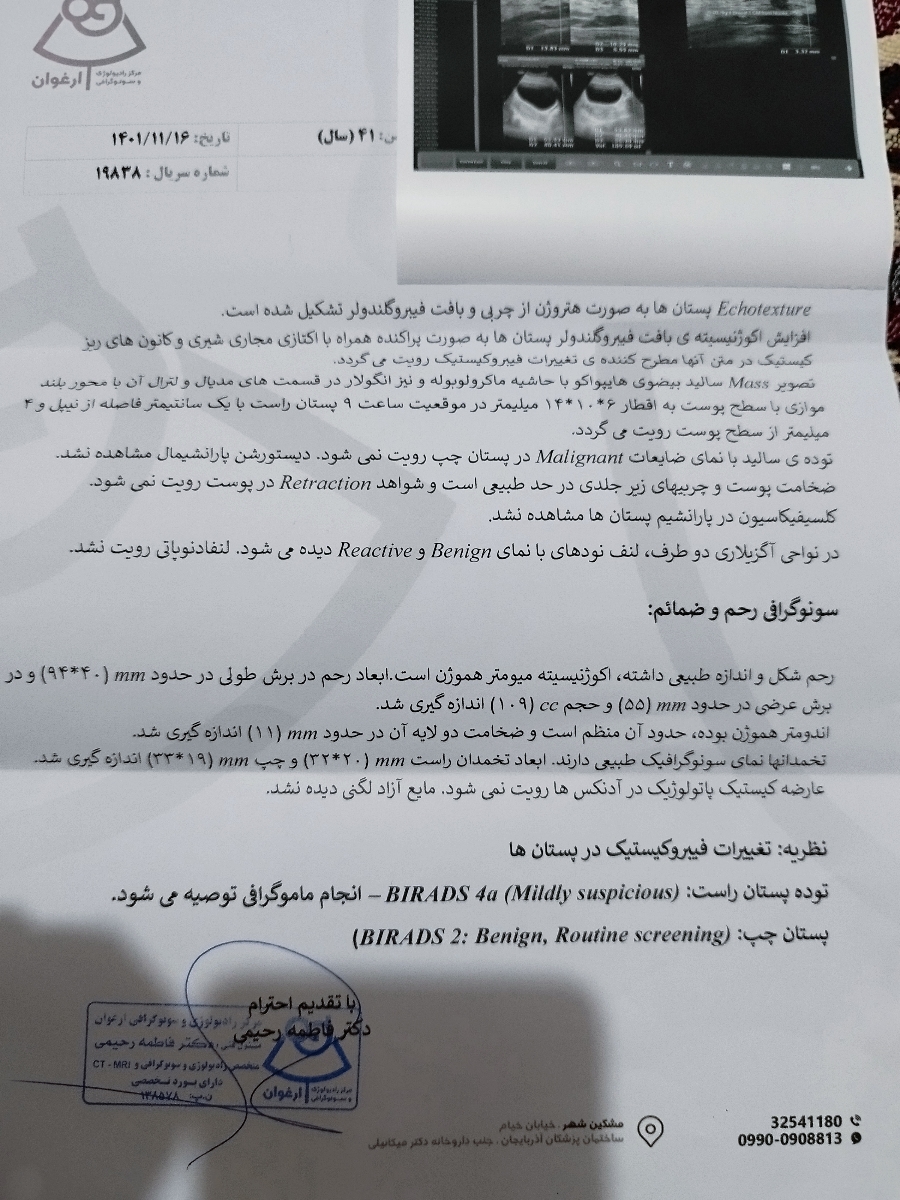 دکتر محترم لطفا سونوگرافی پستان رو تفسیر کنین