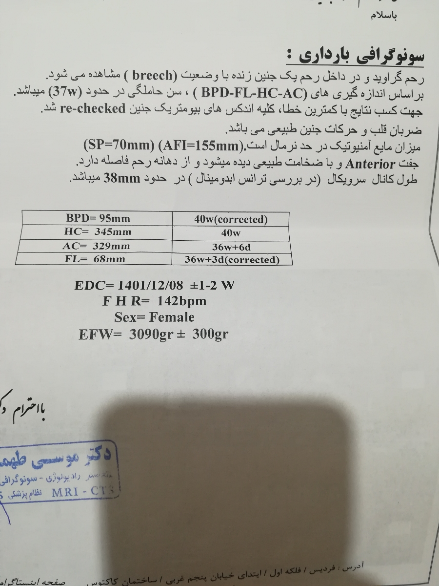بزرگ بودن دور سر جنین بزرگ بودن دور سر جنین
