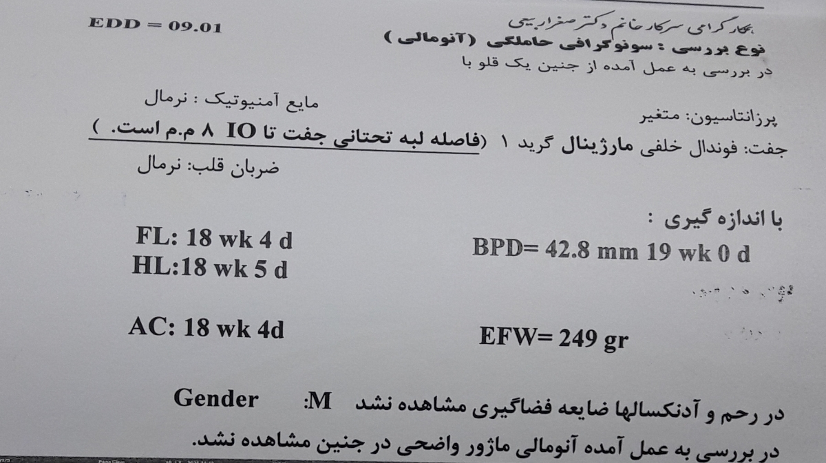 تفسیر سونوی آنومالی اسکن تفسیر سونوی آنومالی اسکن