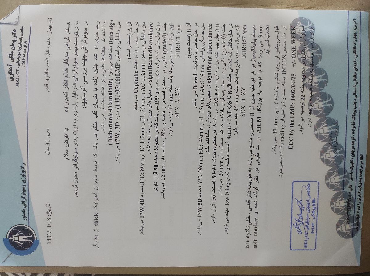 سونوی انومالی بارداری دوقلویی