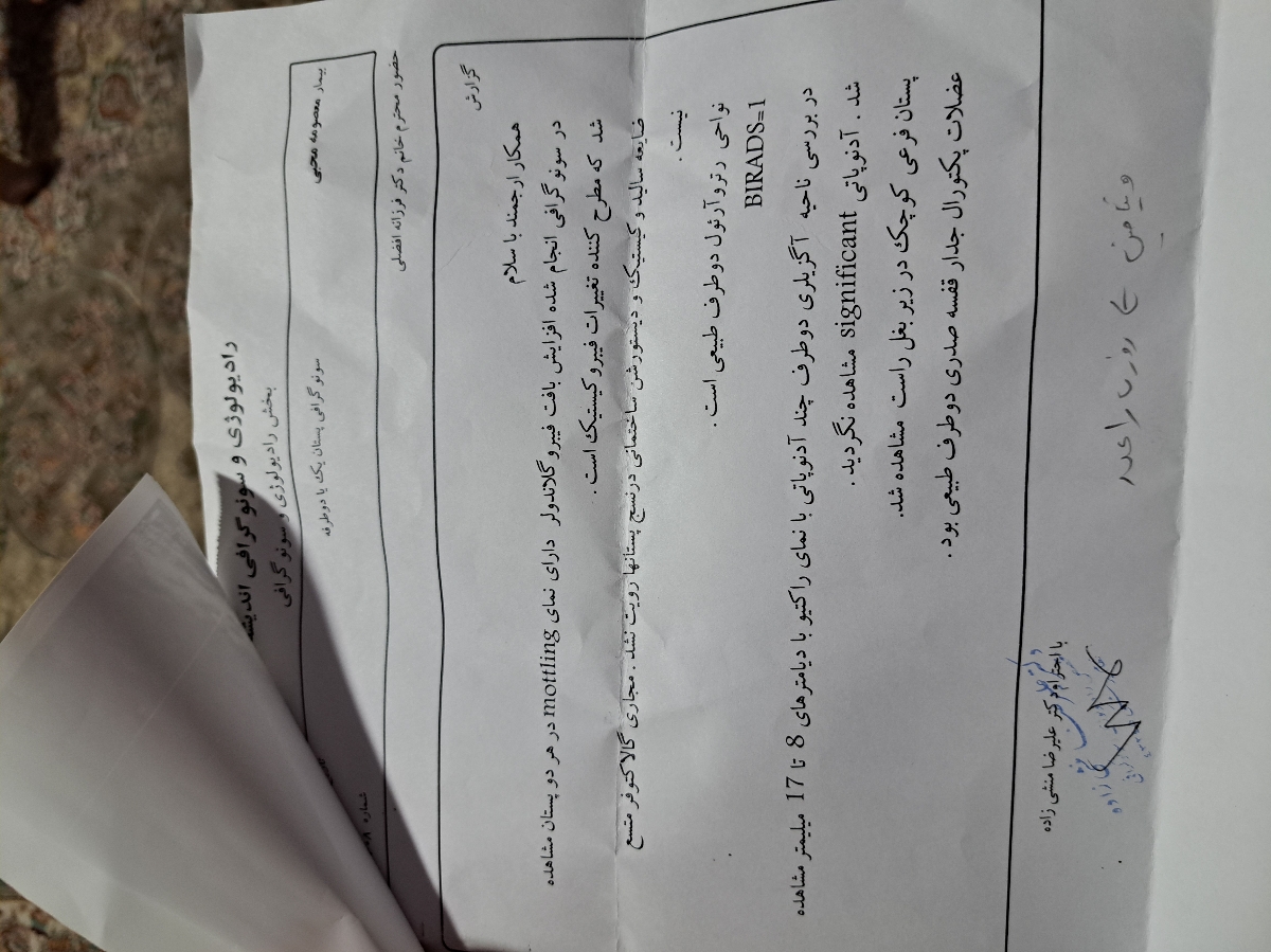سونوگرافی سینه ماموگرافی عکس