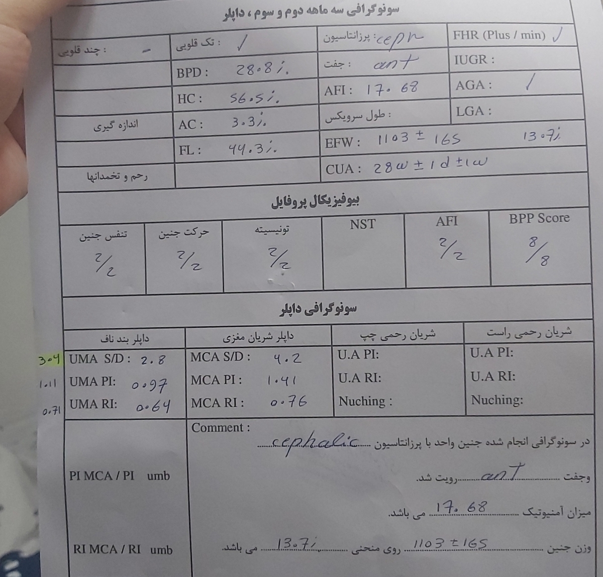 مقاومت شریان نافی در ۲۹هفته