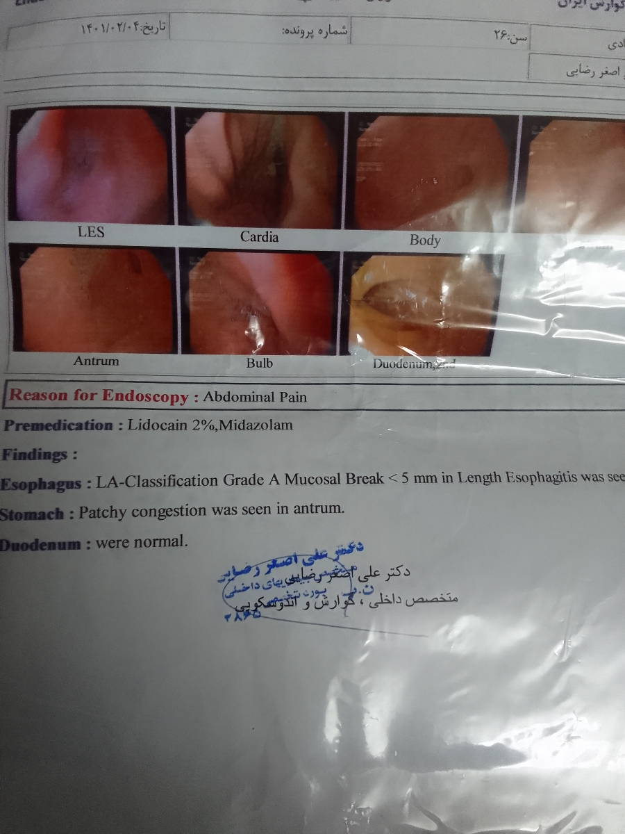تفسیر اندوسکوپی معده ....