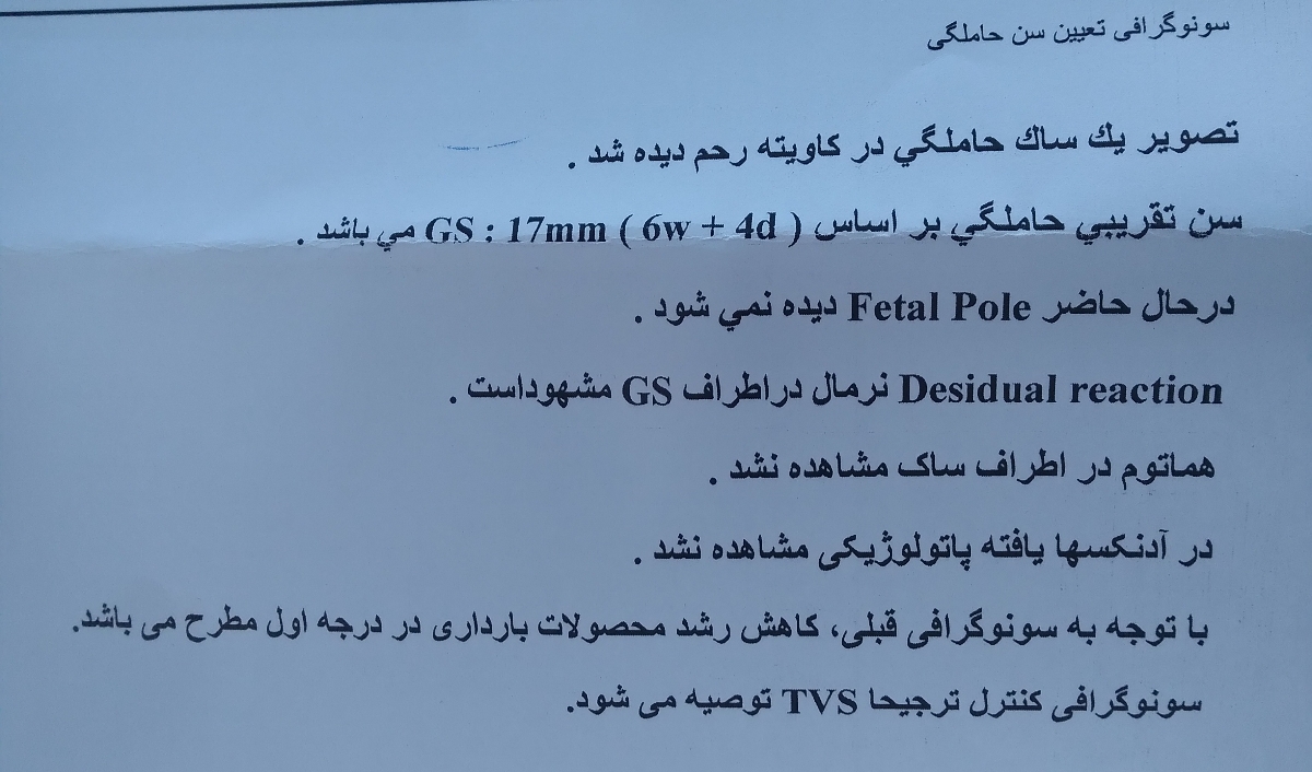 تفسیر سونو تعین سن بارداری تفسیر سونو تعین سن بارداری