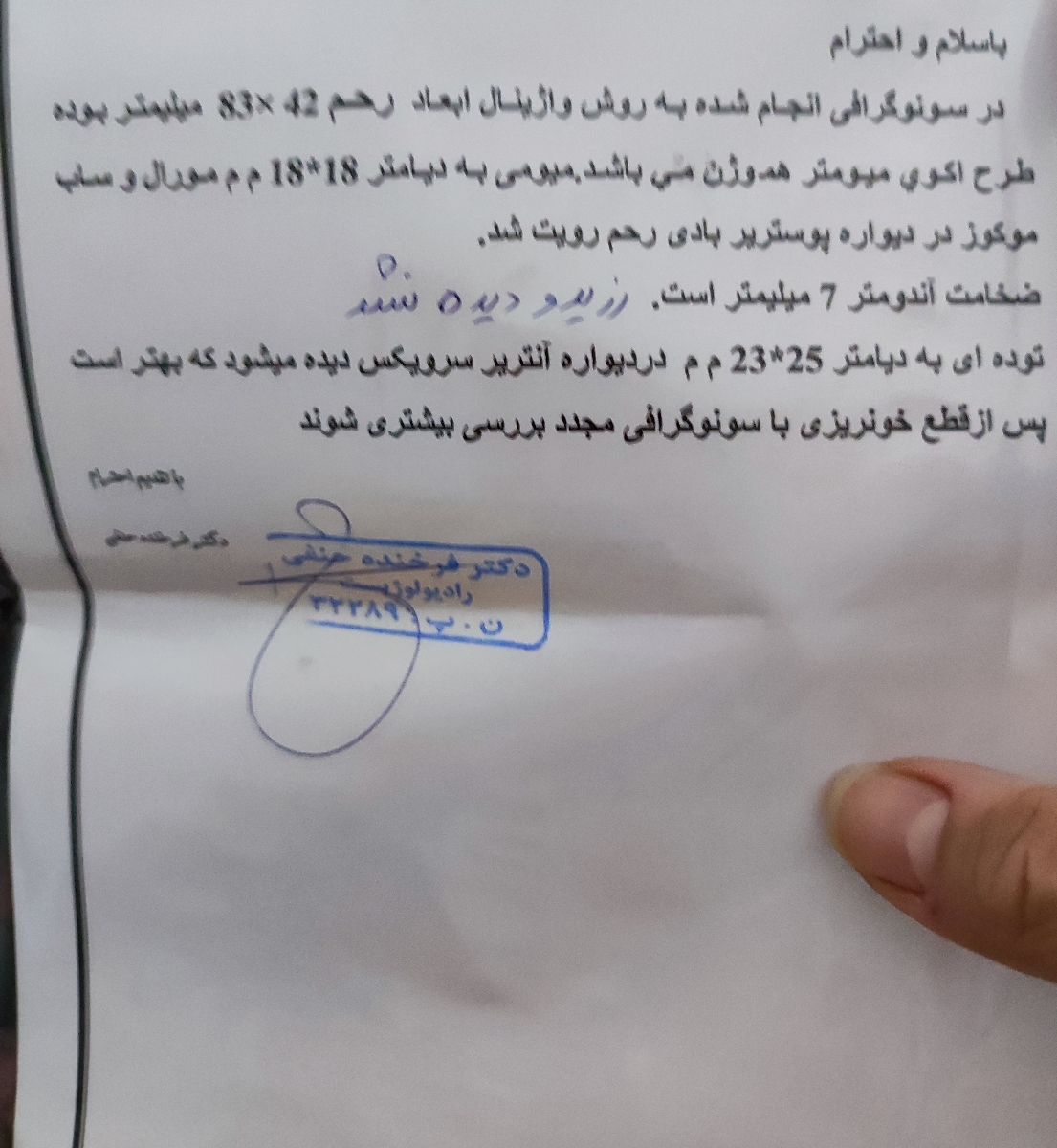 سلام خانم دکتر سونو من رو بعد سقط بررسی میکنید