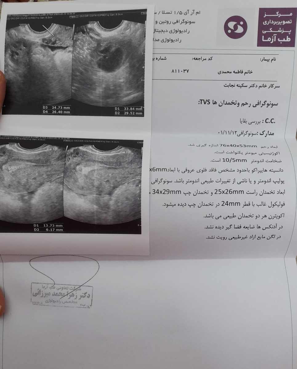 سونو بقایای سقط+عکس سونو