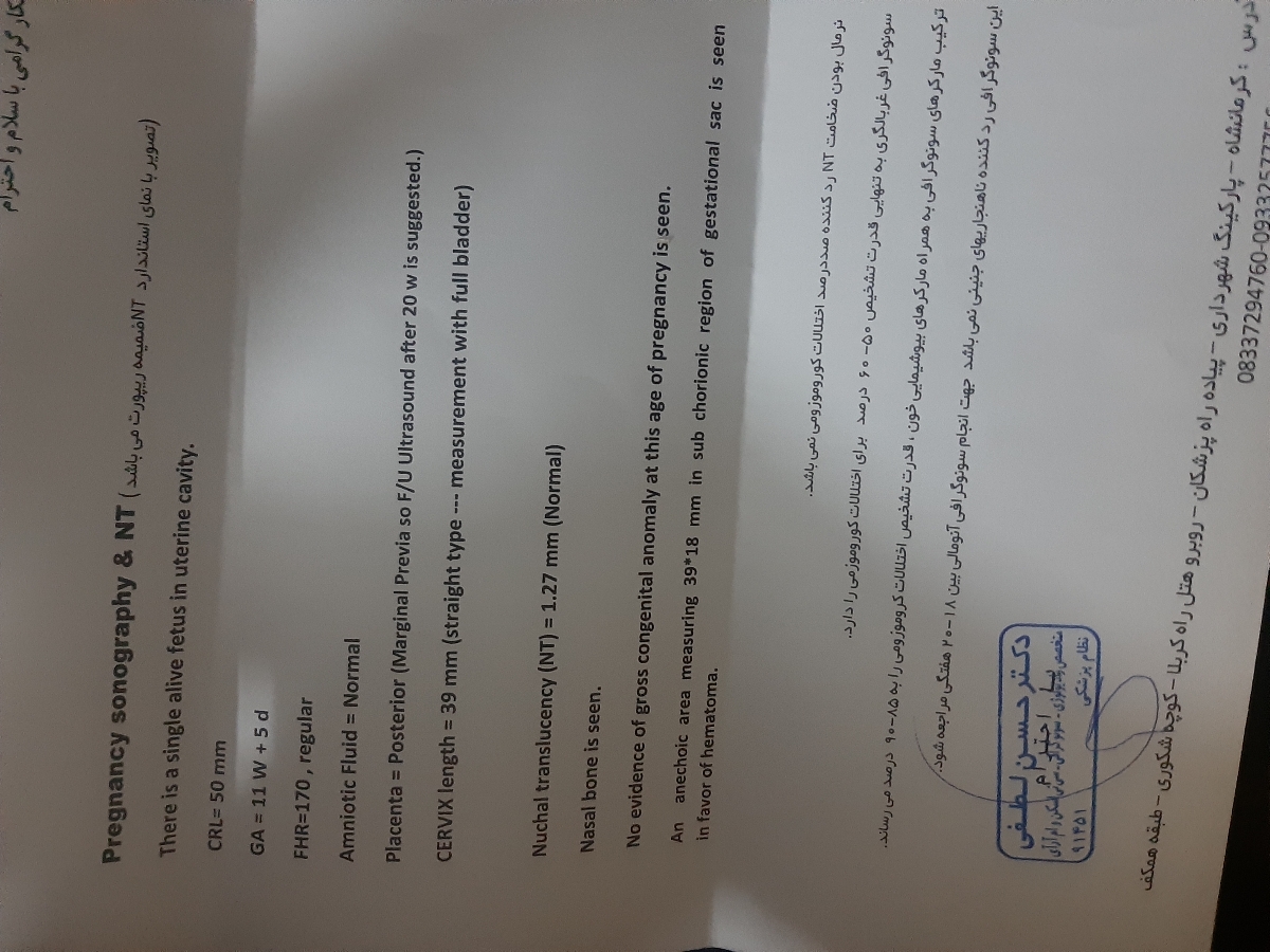 سنو ان تی و ازمایش غربالگری سنو ان تی و ازمایش غربالگری