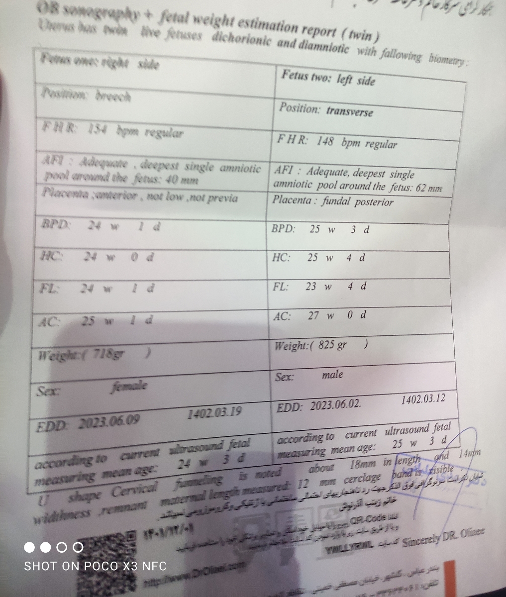 سونو 24هفتگی چکاب سونو 24هفتگی چکاب