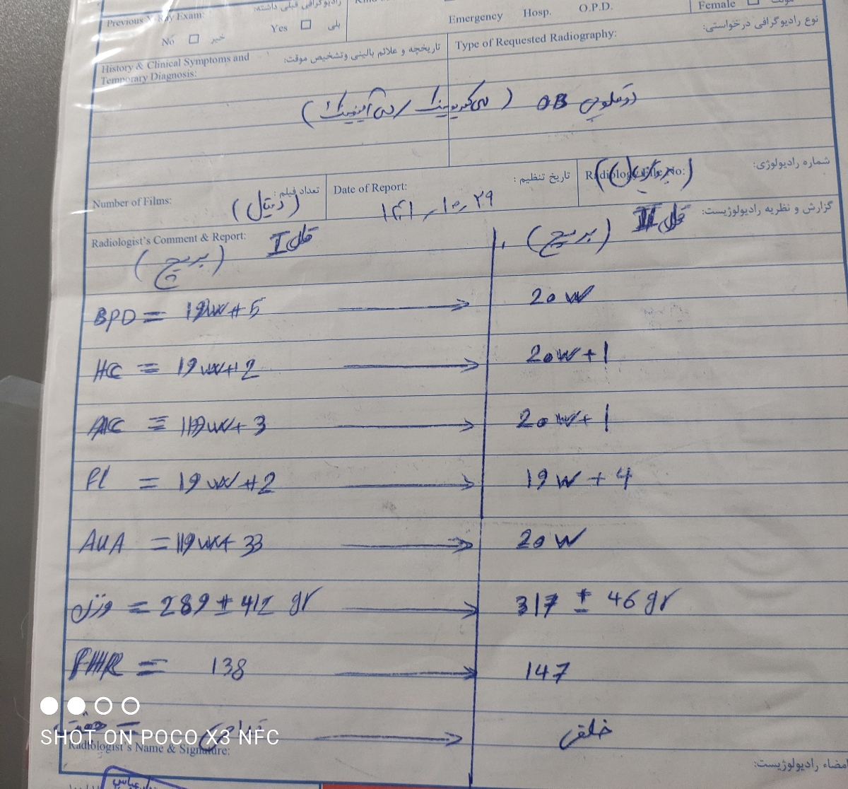 سونو 24هفتگی چکاب سونو 24هفتگی چکاب