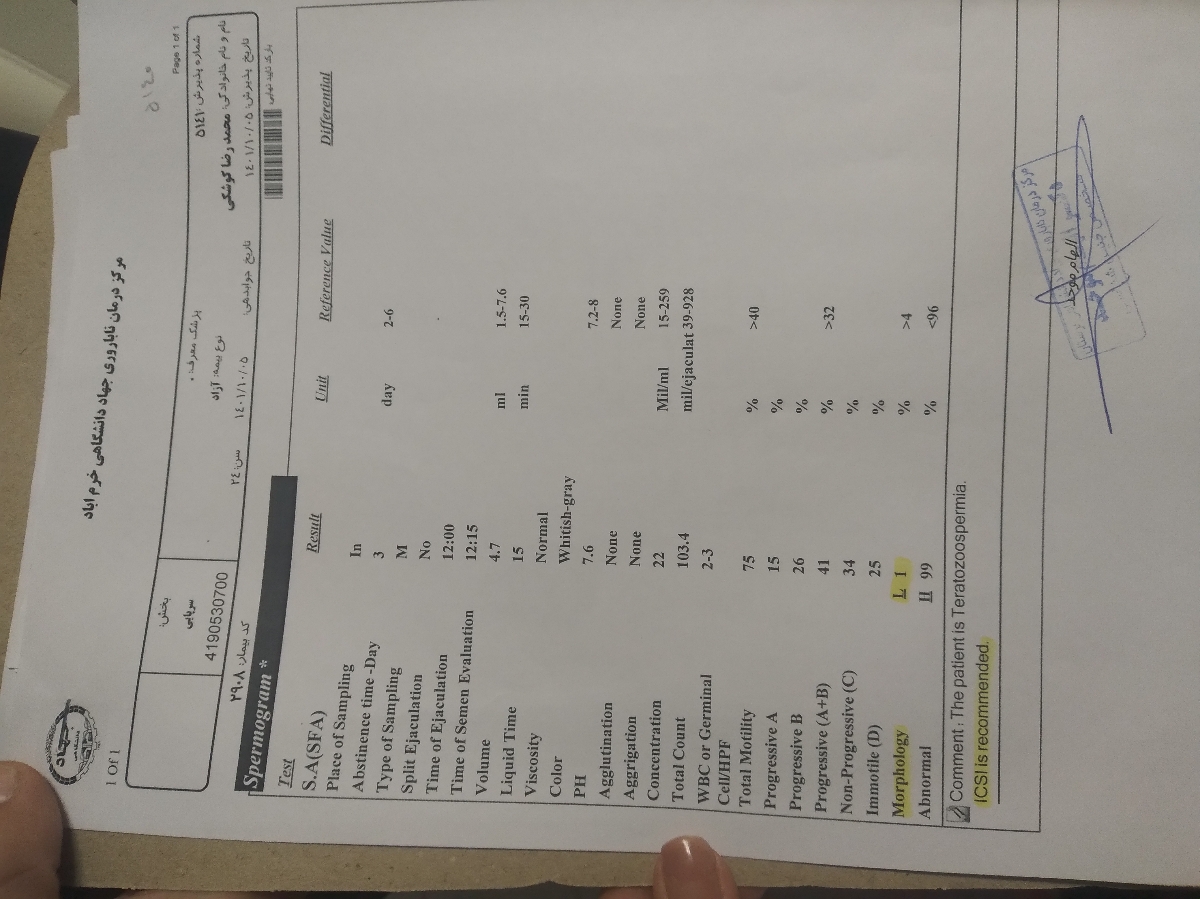 واریکوسل و آزمایش اسپرم گرام واریکوسل و آزمایش اسپرم گرام