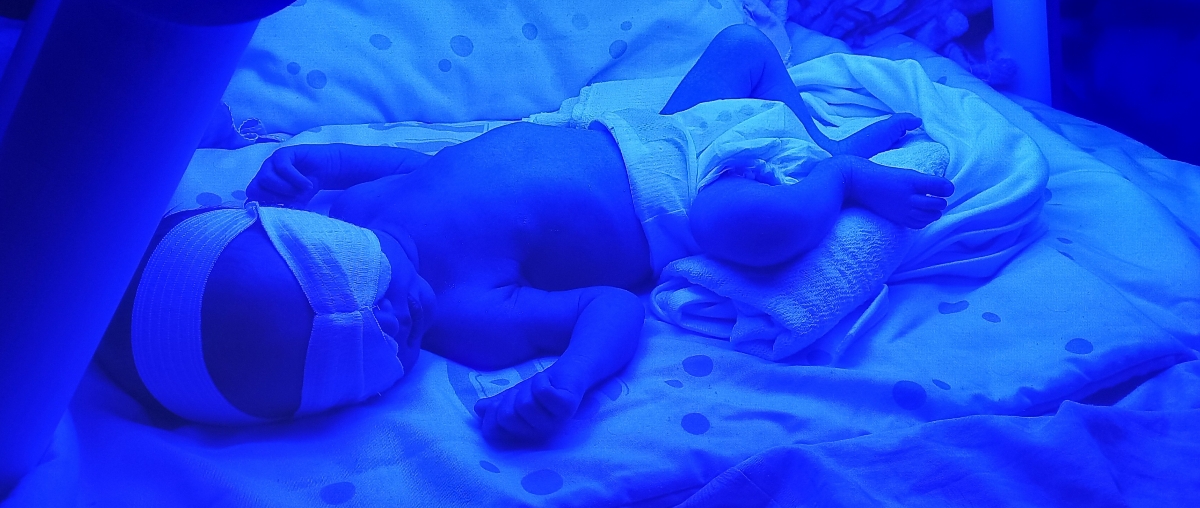 زردی نوزاد ۷ روزه