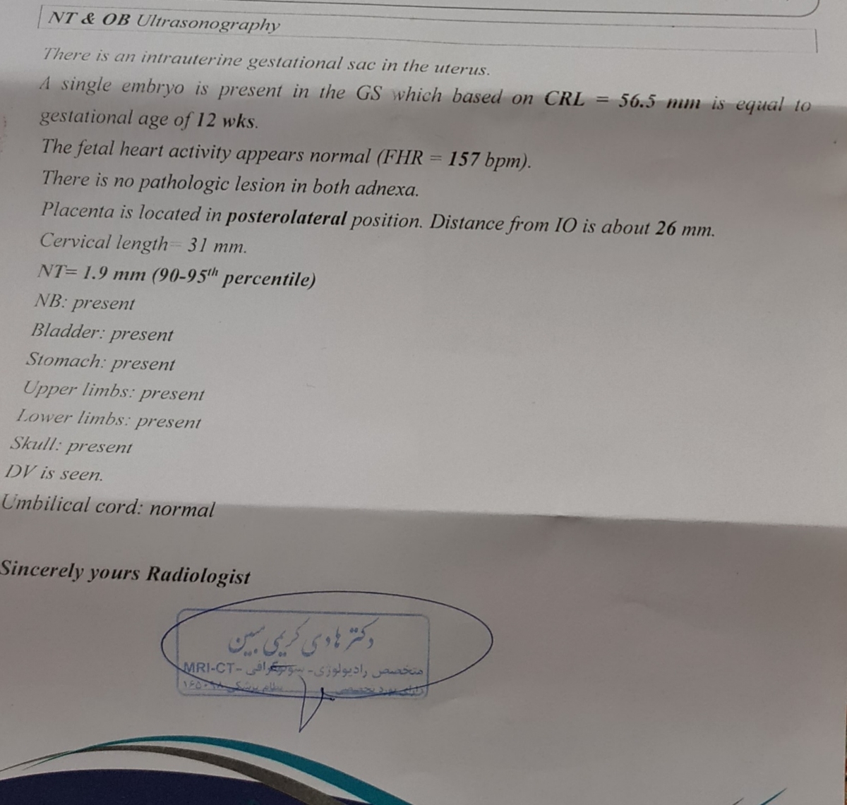 سونو ان تی و تعیین جنسیت
