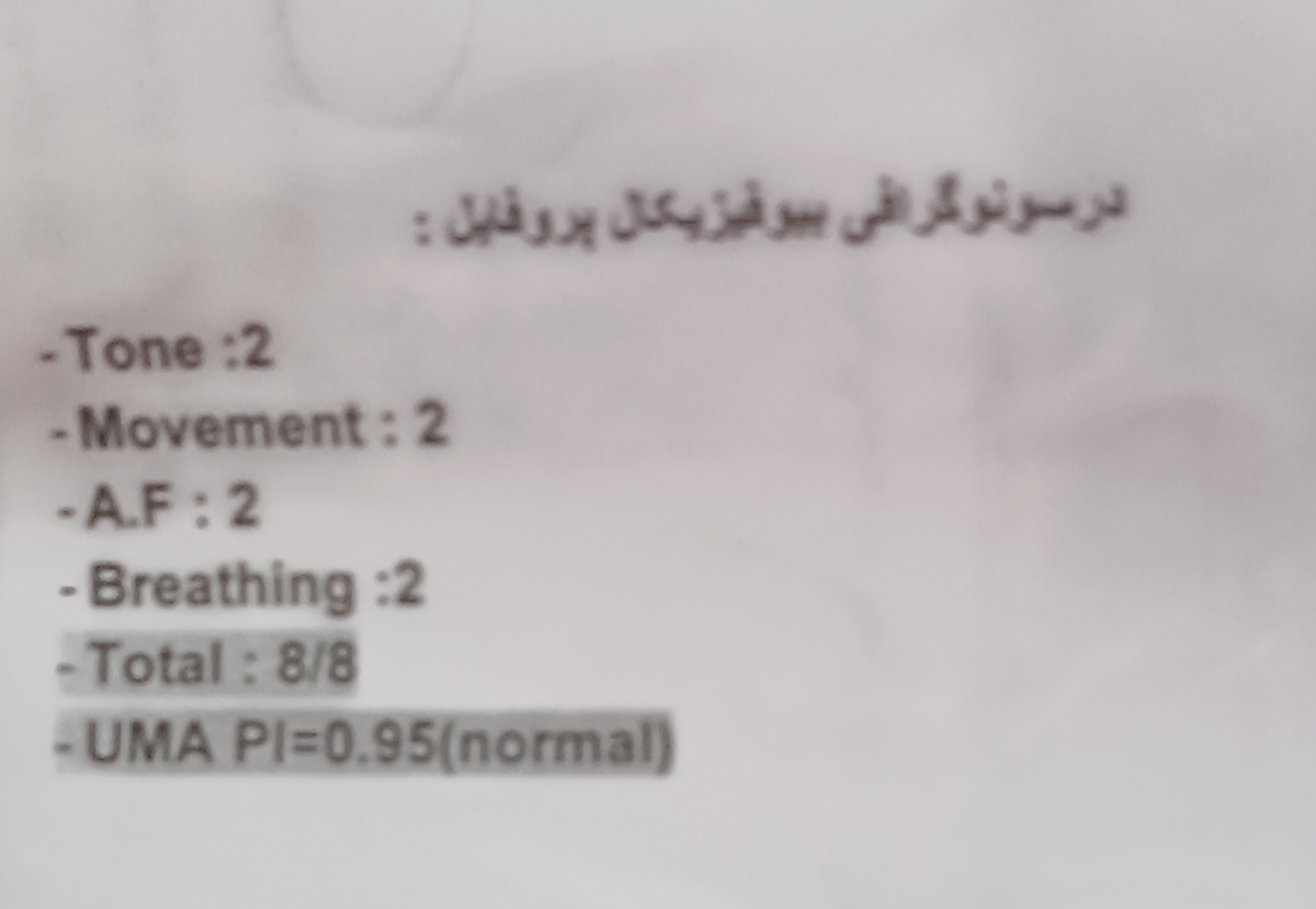 بررسی سونو کالر داپلر و بیو فیزیکال بررسی سونو کالر داپلر و بیو فیزیکال