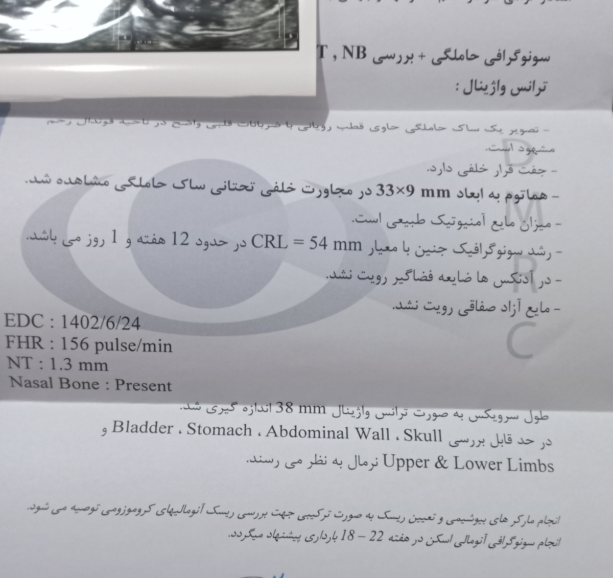 تفسیر جواب سونو ان اتی و داشتن هماتوم تفسیر جواب سونو ان اتی و داشتن هماتوم