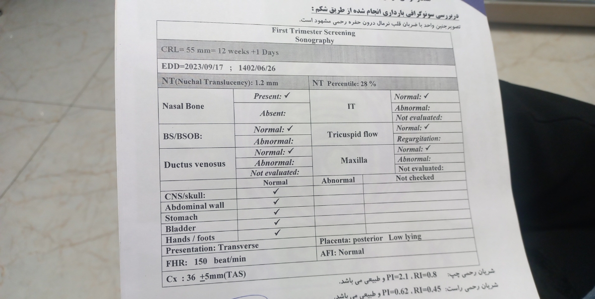 تفسیر سونو ان تی تفسیر سونو ان تی