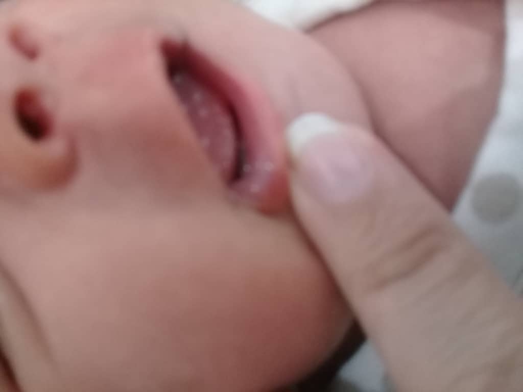برفک دهان نوزاد ۱۴ روزه برفک دهان نوزاد ۱۴ روزه