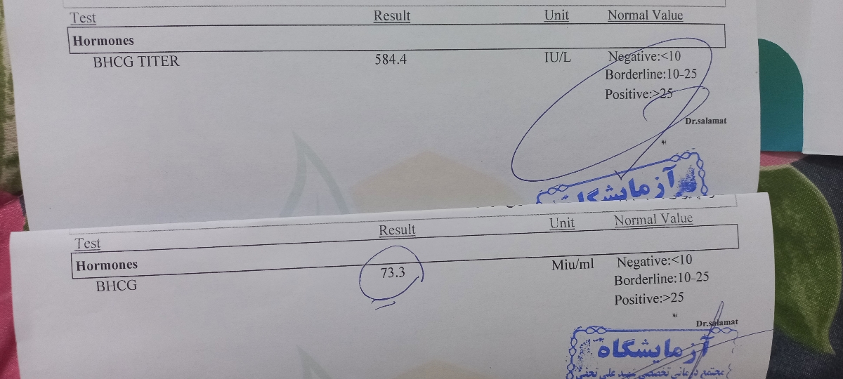 بارداری خارج ازرحم وبتا بارداری خارج ازرحم وبتا