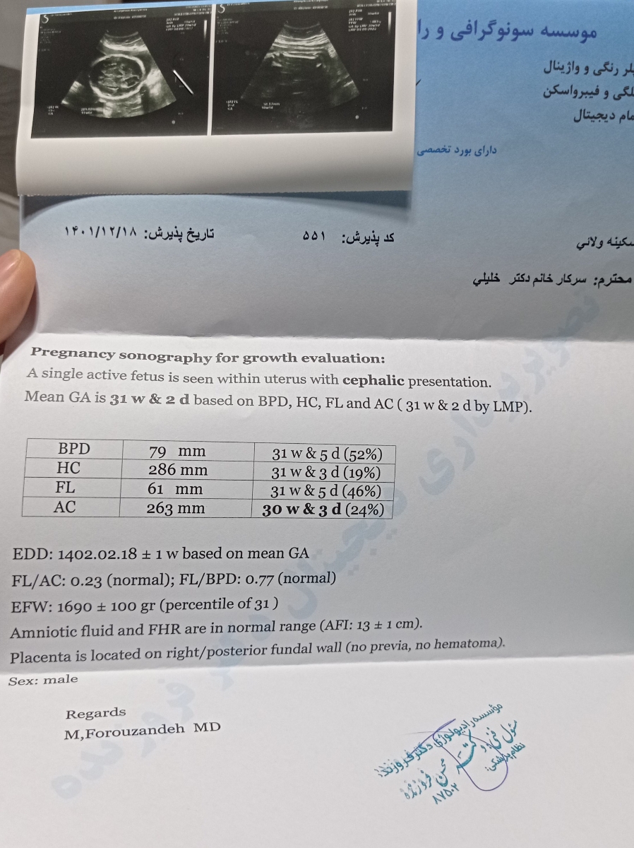 سلام خانوم دکتر نظرتونو راجب سونو۳۲هفتم بگید ممنون میشم... سلام خانوم دکتر نظرتونو راجب سونو۳۲هفتم بگید ممنون میشم...