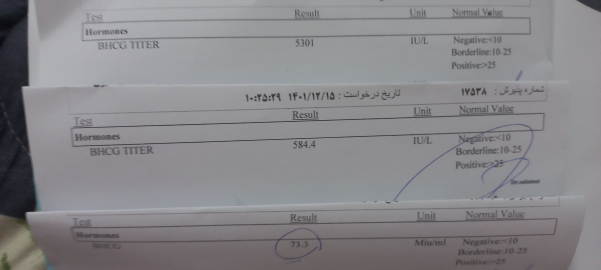 بارداری خارج ازرحم وبتا بارداری خارج ازرحم وبتا